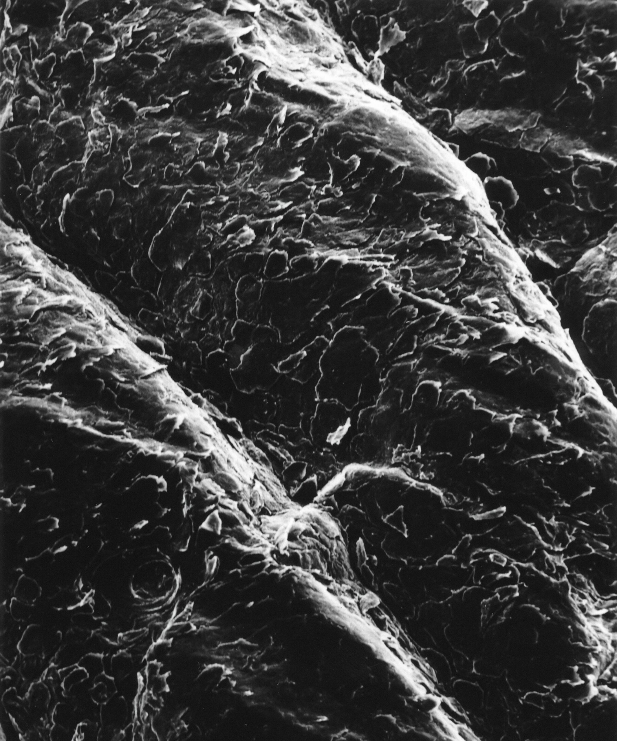 A Scanning Electron Micrograph Of The Surface Of Human Skin